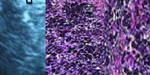 Analytical Study of Pancreatitis in Dogs